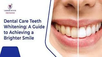 A Comprehensive Review of Teeth Whitening Kits: The Path to a Brighter Smile