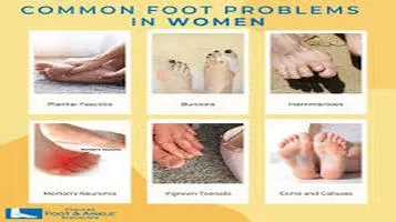 Comprehensive Insights into Common Foot Problems and Solutions