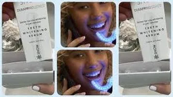 Review of the Snow Teeth Whitening Kit: A Comprehensive Analysis