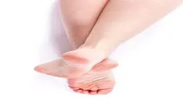 Remedies for Cracked Heels: A Comprehensive Review